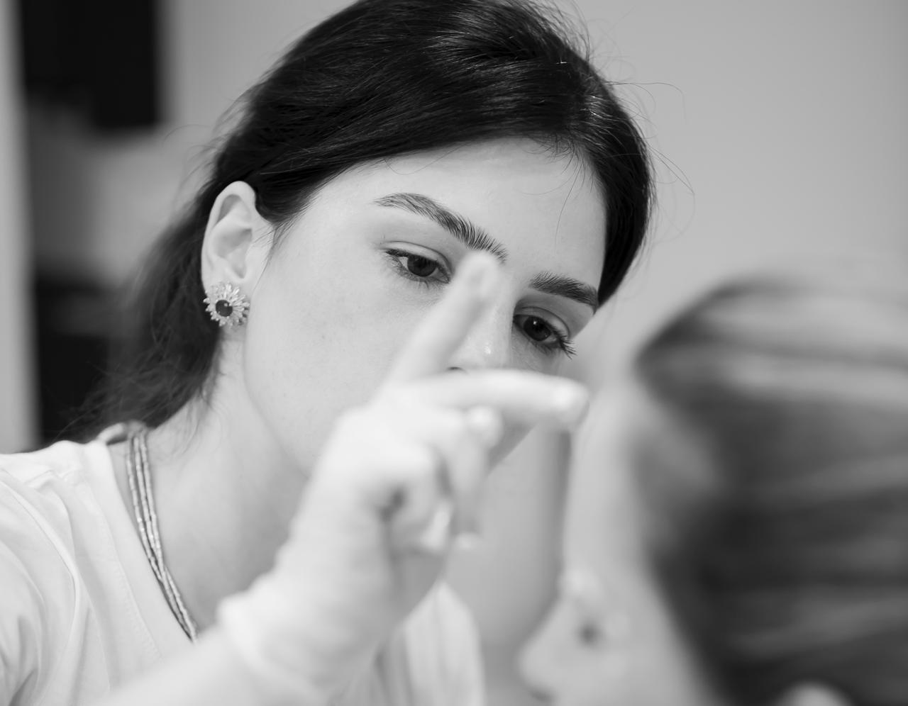 Preenchimento com ácido hialurônico - Dra. Juliana Araújo, dermatologista em Barbacena